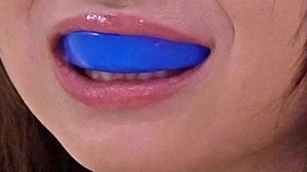 A blue mouthguard